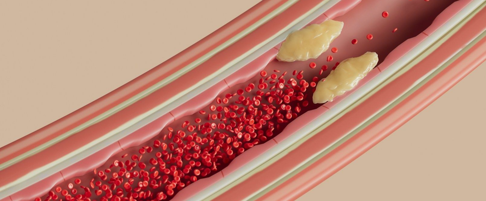 Fisioterapia Domicilio Vascular Madrid