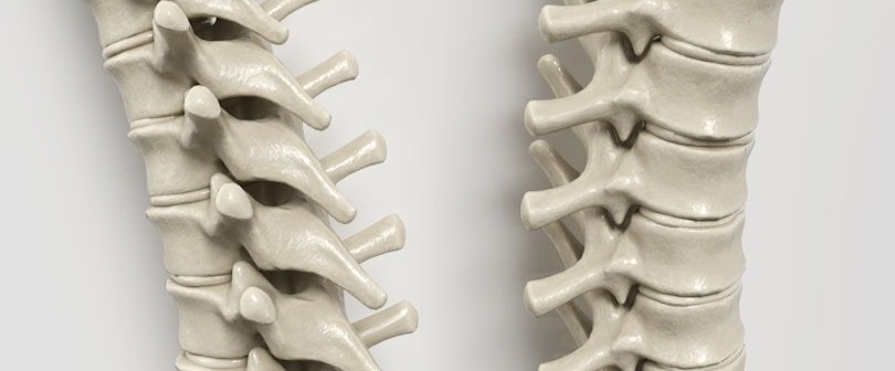 Fisioterapia a domicilio Artrosis Madrid