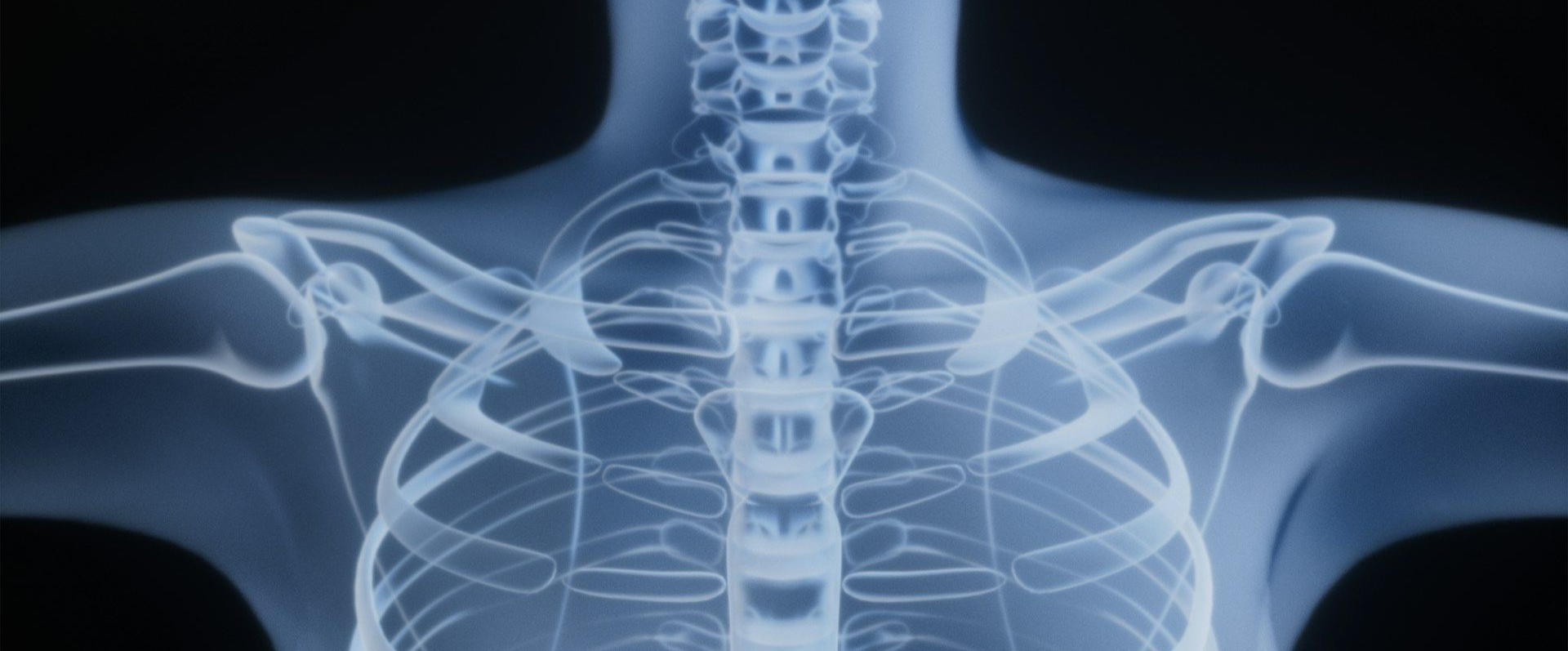 Fisioterapia a domicilio en latigazo cervical