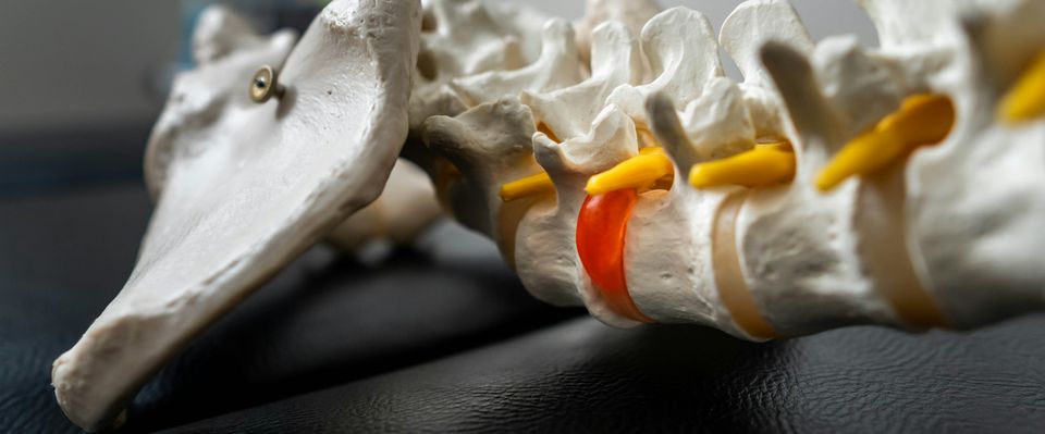 Fisioterapia Domicilio Síndrome del Piramidal.