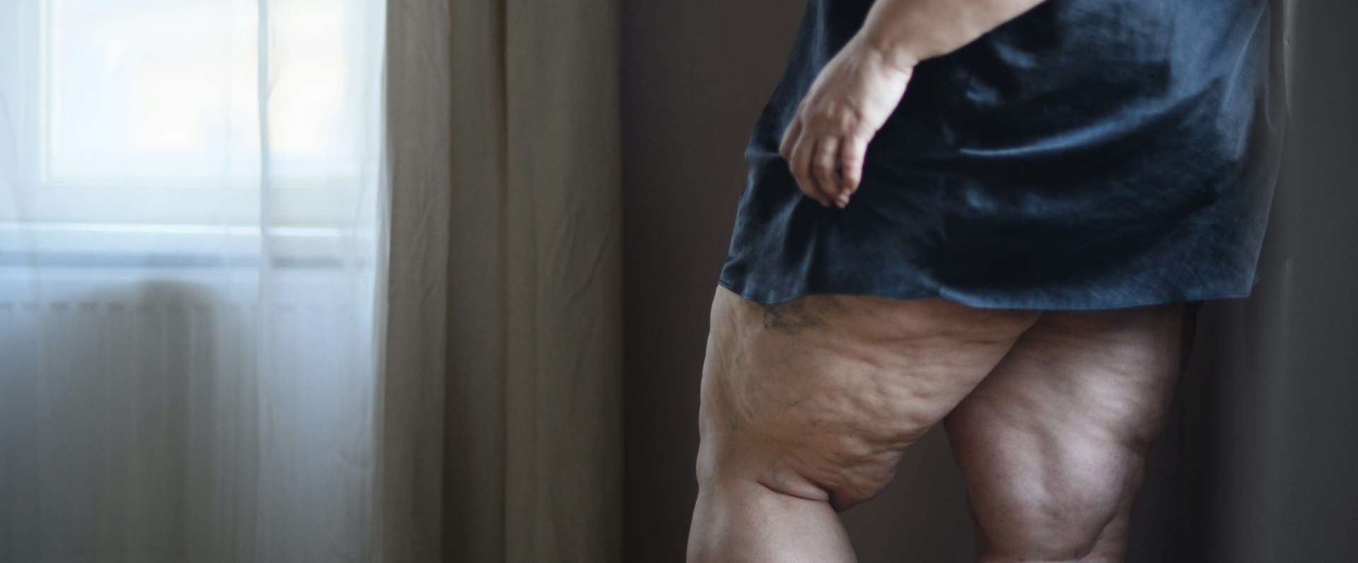 Fisioterapia Domicilio Dermatofuncional.