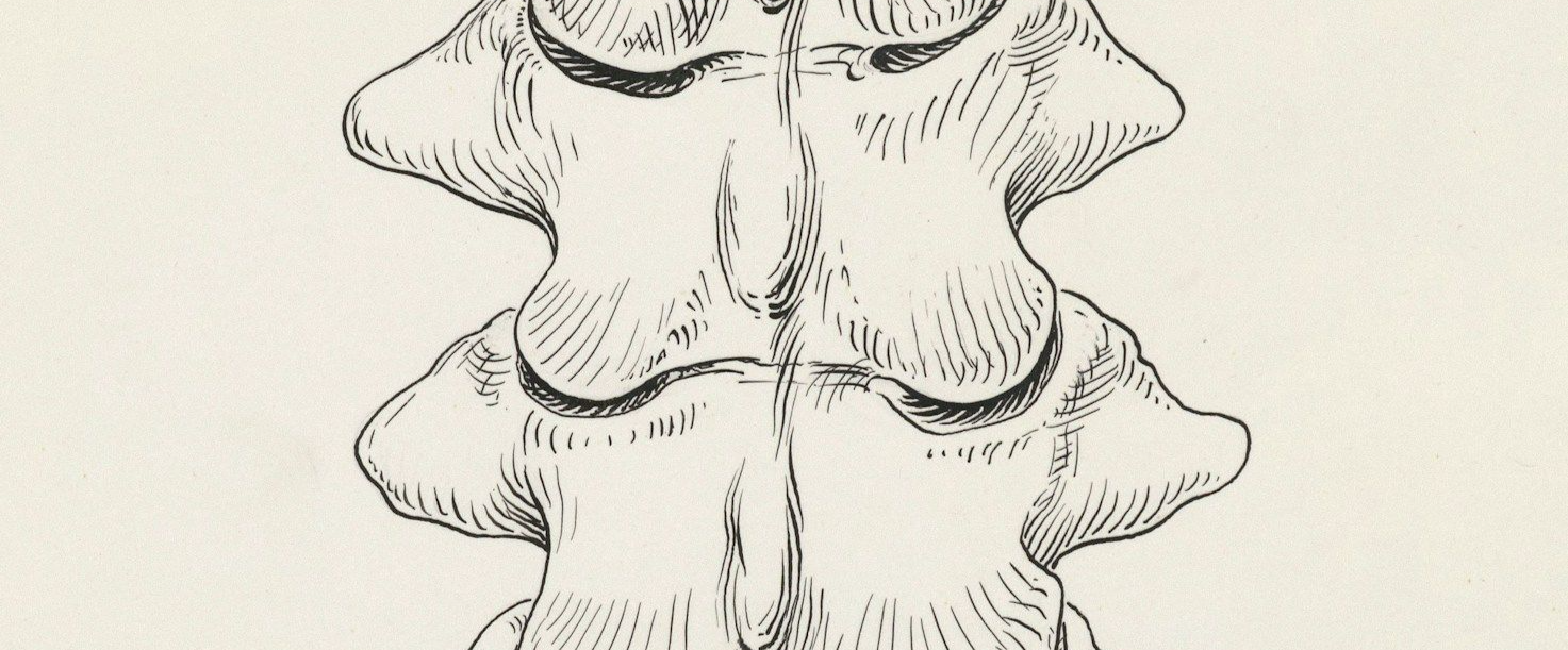 Fisioterapia Domicilio Espondilitis.