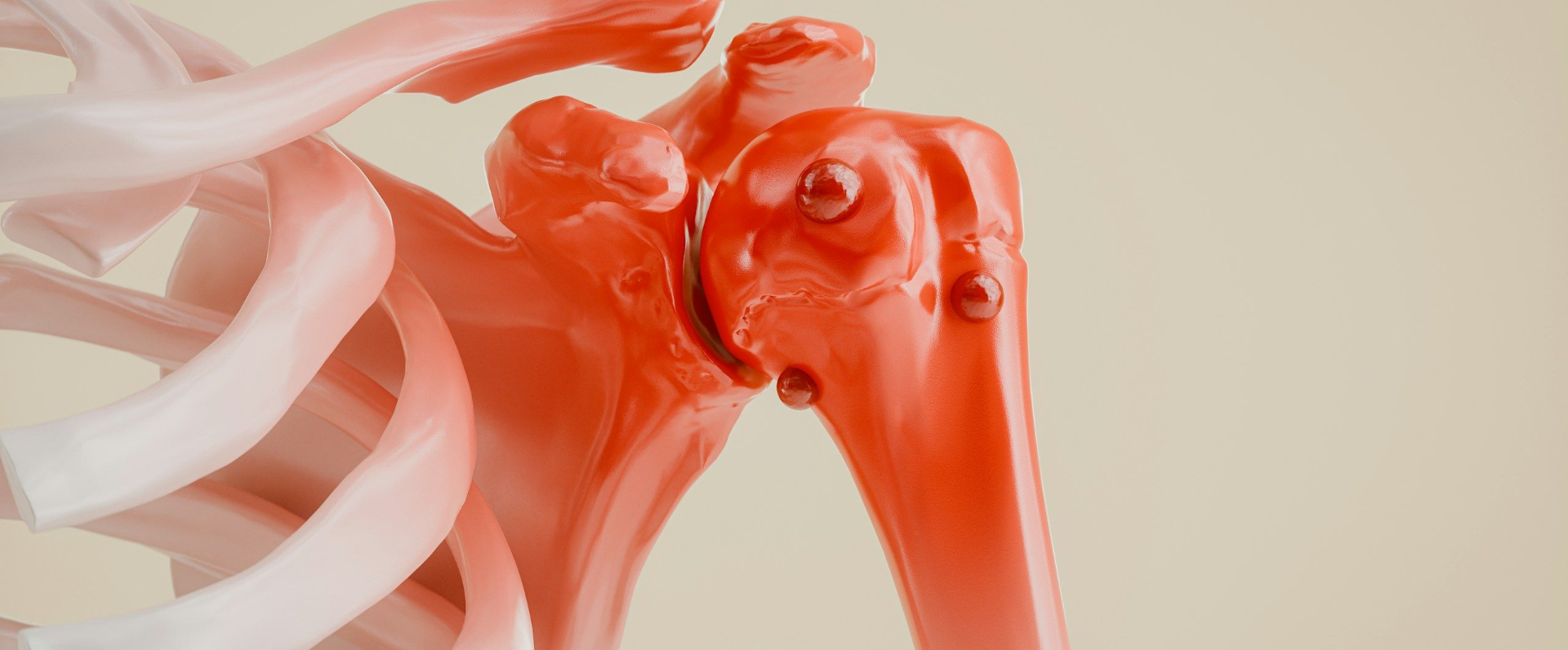 Fisioterapia Domicilio Inestabilidad Hombro.