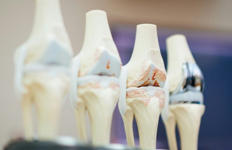 Fisioterapia a domicilio en Calle Velázquez Barrio de Salamanca.